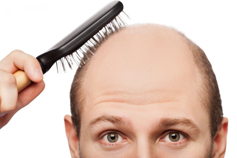  cure your baldness