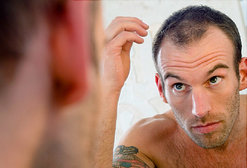 baldness treatment